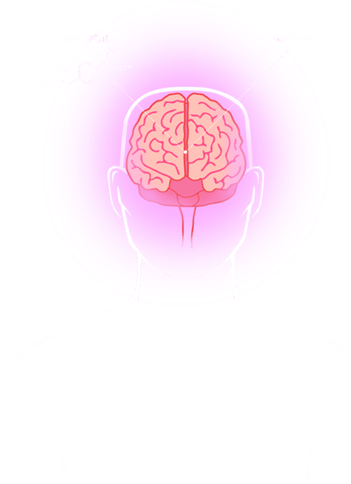 Migraine-2 Migraine-2
