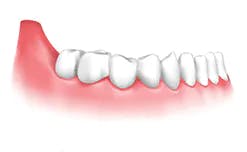 snap on dentures icon