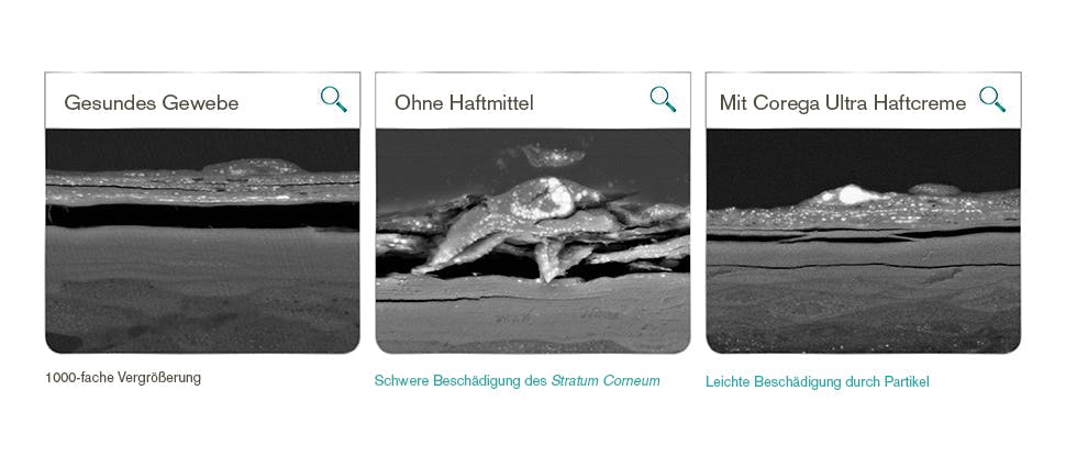 Corega Ultra Haftcreme hilft, Reizungen der Gingiva zu reduzieren durch Schutz vor eindringenden Speiseresten.