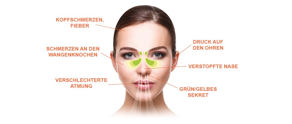 Sinusitis symptoms