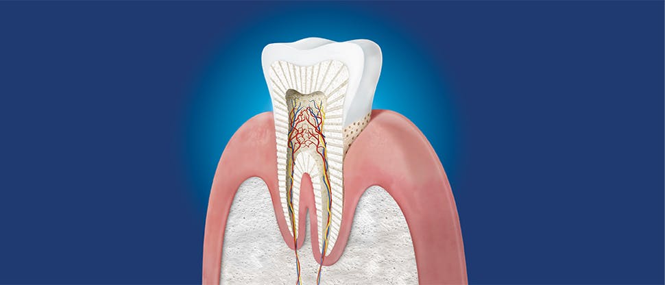 Dentintubuli und Kaliumnitrat