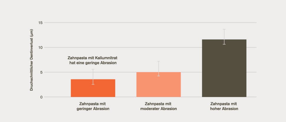 GSK_GEP_Sen_19_D Balkendiagramm – Durchschnittlicher Dentinverlust