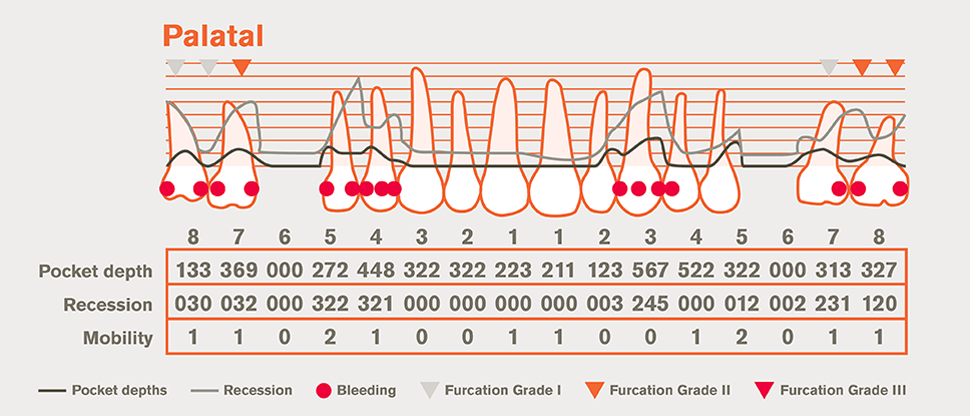 How to Diagnose Gum Inflammation and Disease | Corsodyl