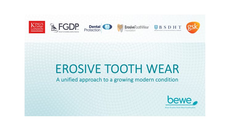 no videos deck final Erosive Toothwear presentation