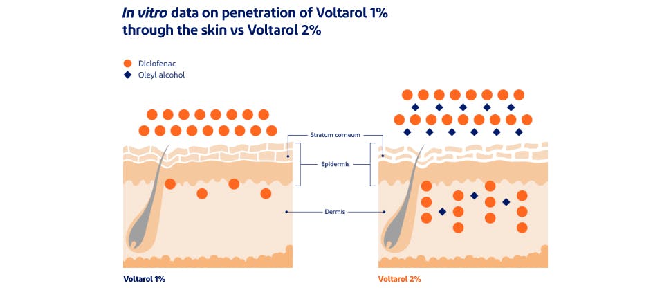 Voltarol Emulgel P 1 W W Gel