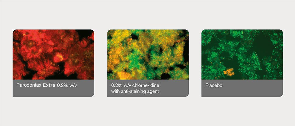 Plaque biofilms determined by image analysis program Plaque biofilms determined by image analysis program