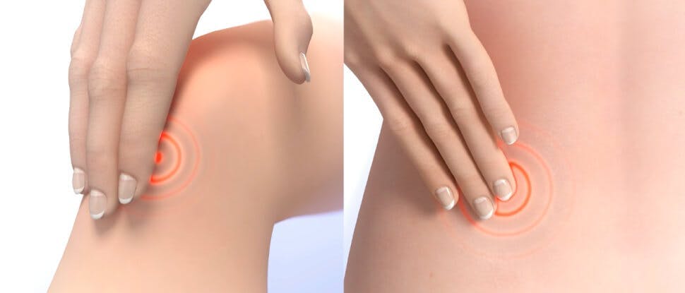 Applying Voltaren 11,6mg/g gel - Double Effect