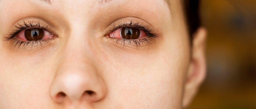Woman with red eyes