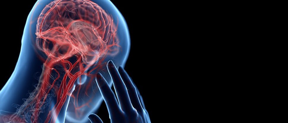 Head_ache image
