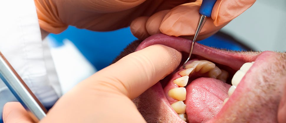 354504170 Dental patient with gum disease at practice reception