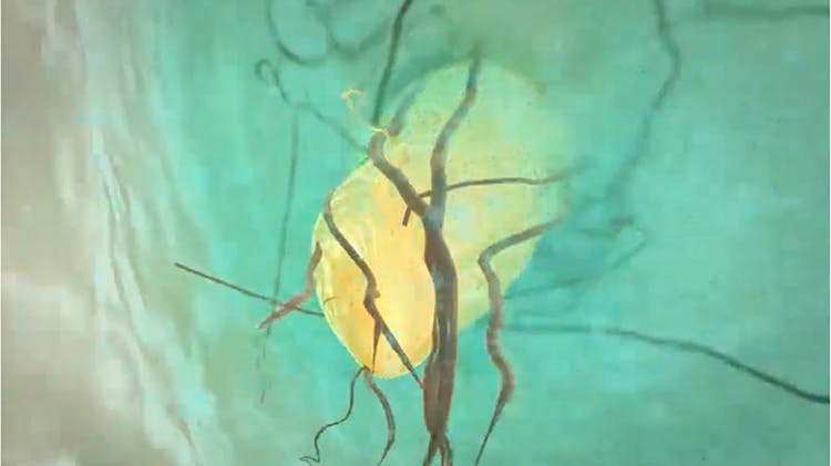 potassium nitrate image