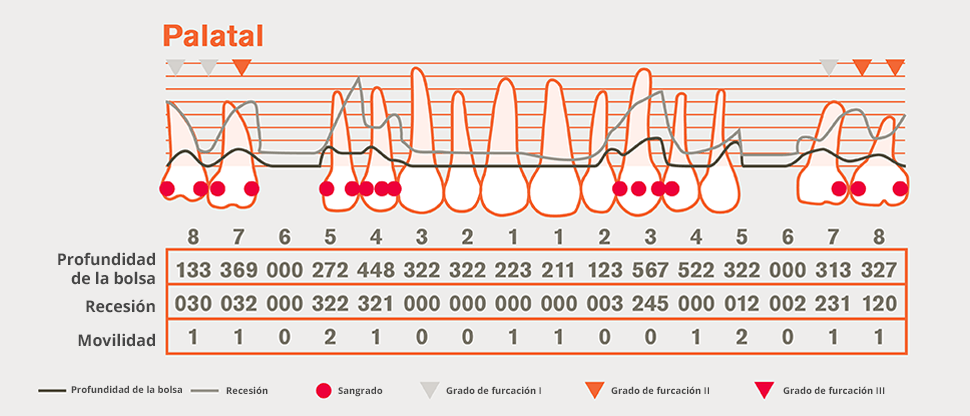 Gráfico periodontal detallado