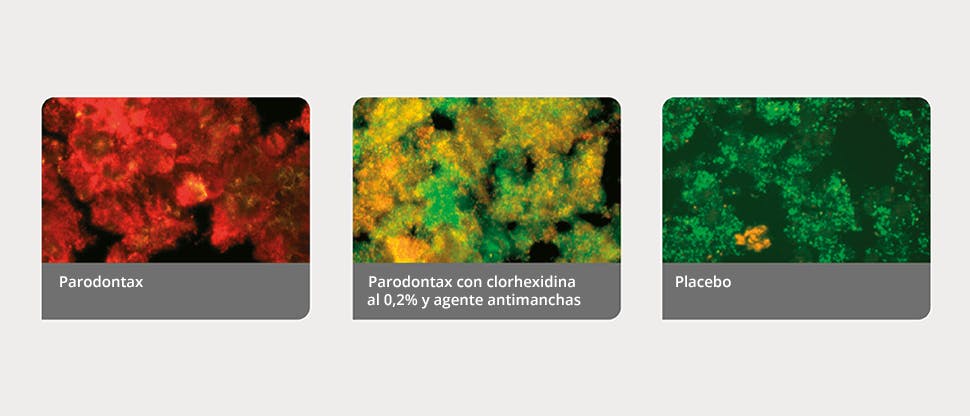 Plaque biofilms determined by image analysis program Biopelículas de placa definidas por un programa de análisis de imágenes