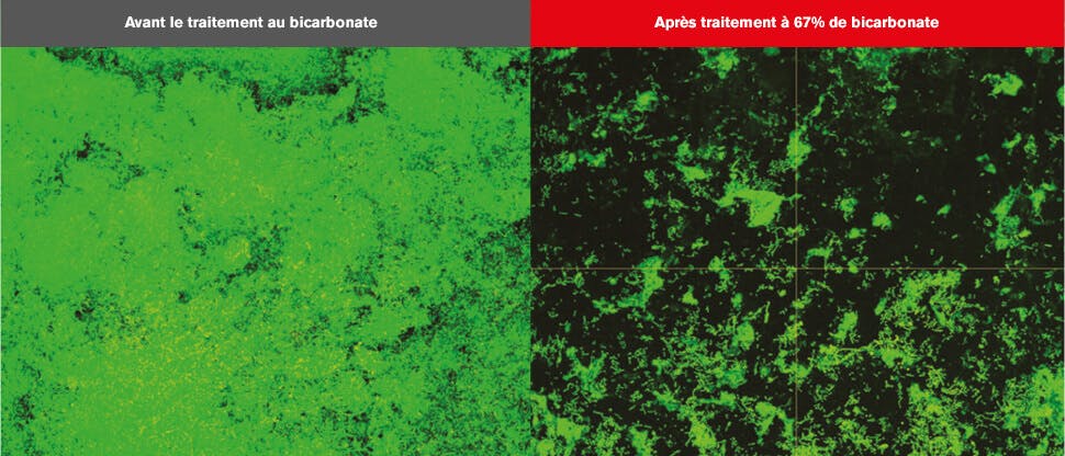 Images au microscope confocal à balayage laser (MCBL) du biofilm