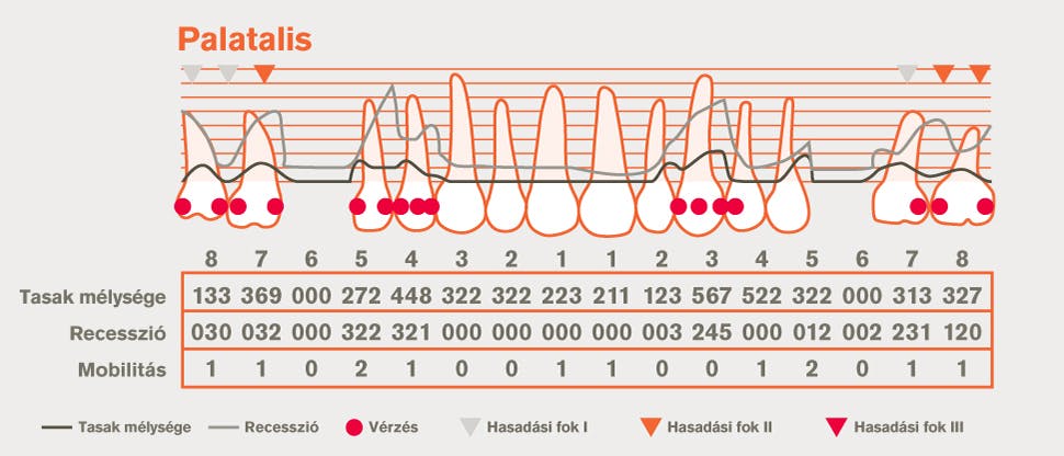 Részletes parodontális ábrázolás