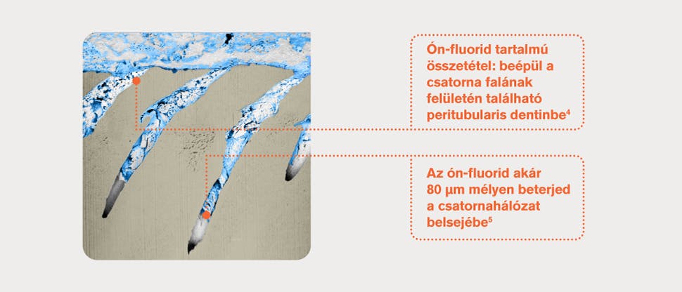 Dentincsatornákról készült reprezentatív FIB-SEM felvétel