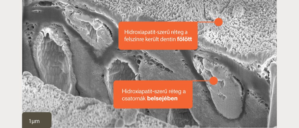 in vitro keresztmetszet, SEM felvétel