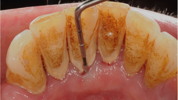 PUNTEGGIO BPE 2