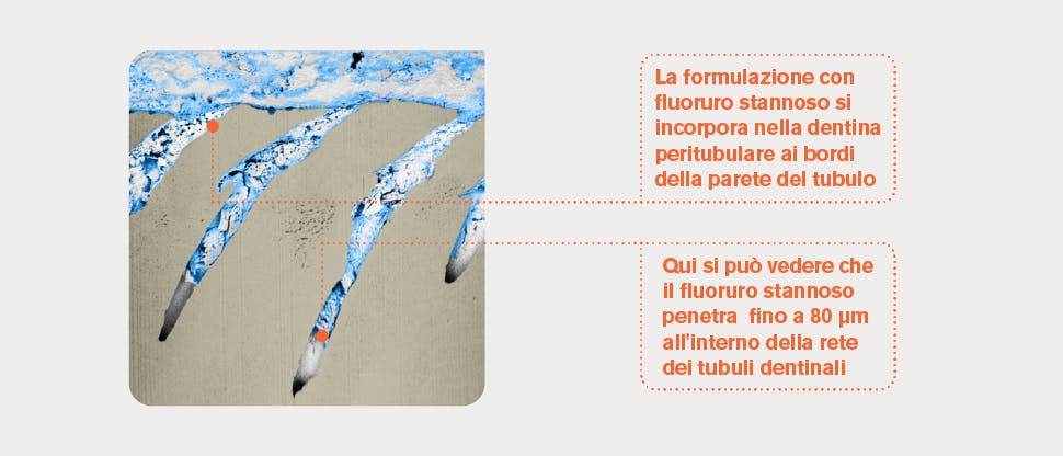 Immagine rappresentativa FIB-SEM dei tubuli dentinali