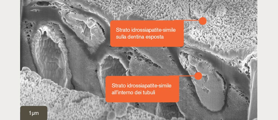 SEM image of hydroxyapatite-like layer