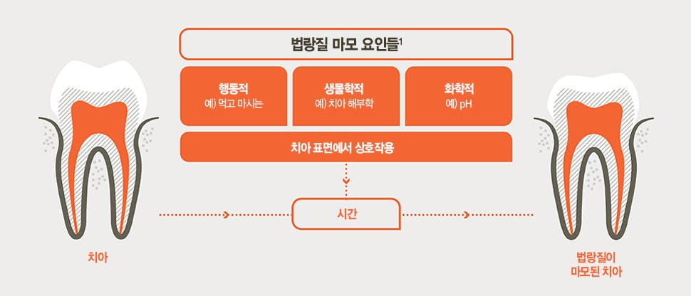법랑질 마모의 원인