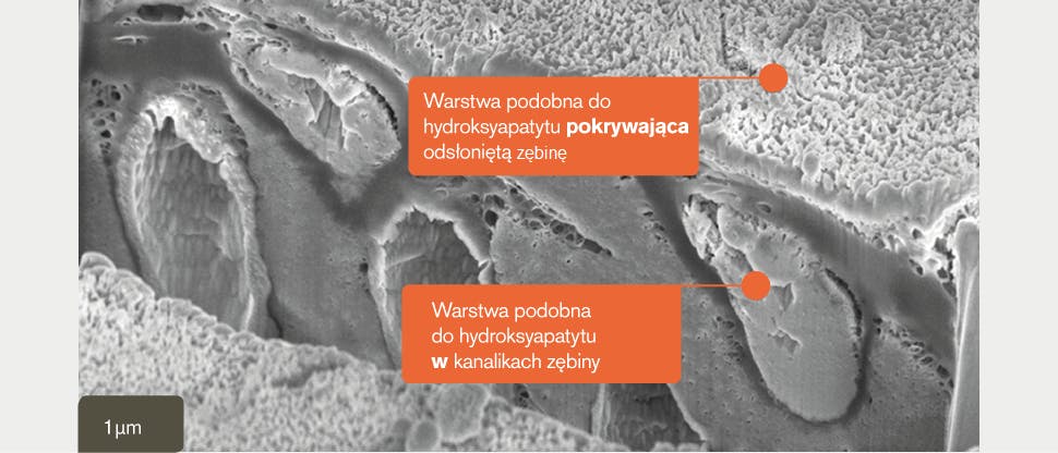 Sekcja in vitro X obraz SEM
