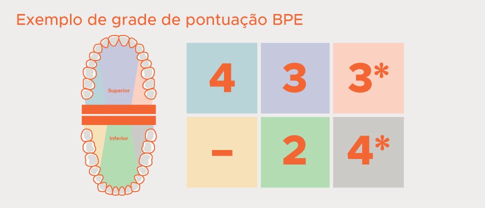 Divisão BPE da dentição em sextantes e exemplo de grade