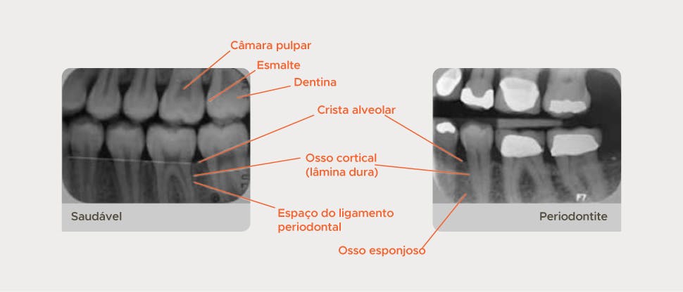 Radiografica anotada
