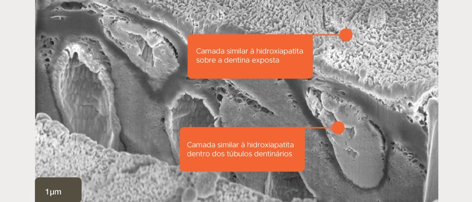 Imagem SEM de seção transversal in vitro