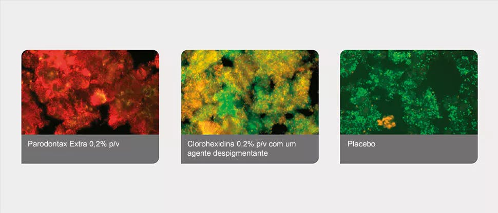 Biofilmes de placa bacteriana tratados por análise de imagem Biofilmes de placa bacteriana tratados por análise de imagem