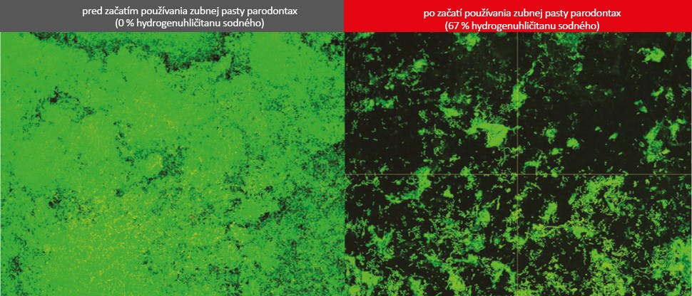 Snímky z biofilmu z konfokálnej laserovej skenovacej mikroskopie (CLSM)