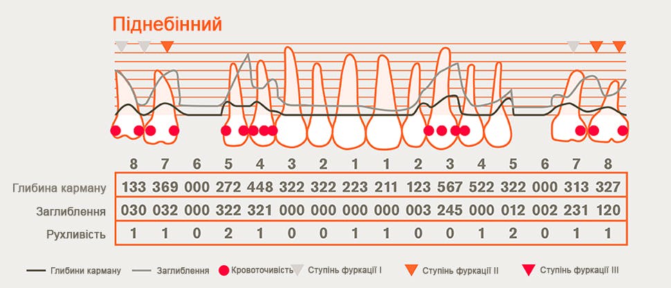 Детальна пародонтологічна карта