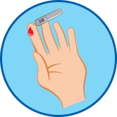 Athlete's Foot Pictures - Weakened Immune System Athlete's foot pictures - weakened immune system