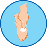 Athletes Foot Cure - Wash and Dry feet then apply LamisilAT Cream Athletes foot cure wash and dry feet then apply LamisilATcream