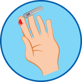 Athlete's Foot may be More Common in People With Diabetes Athlete's foot may be more common in people with diabetes