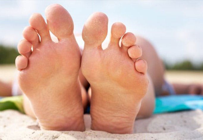 photo What Does Athlete's Foot Look Like Pictures foot tinea pedis signs symptoms