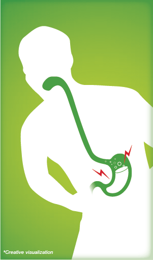 What Are The Main Indigestion Symptoms What Are The Main Indigestion Symptoms