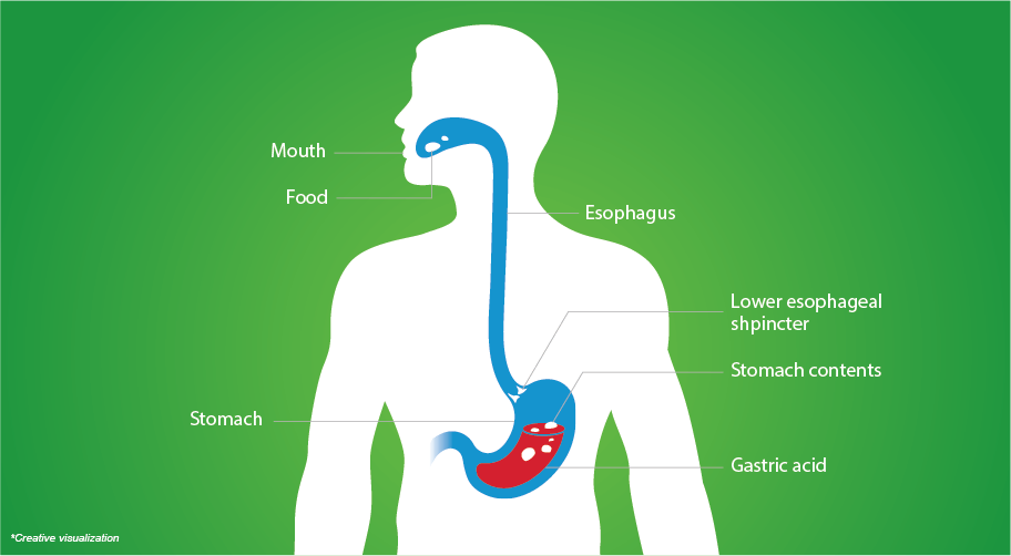 Know your Acidity better Diagram to describe Acidity
