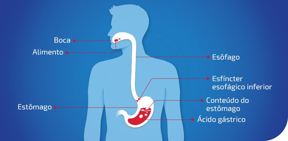 Entendendo A Acidez Causas Sintomas E Tratamentos Eno®