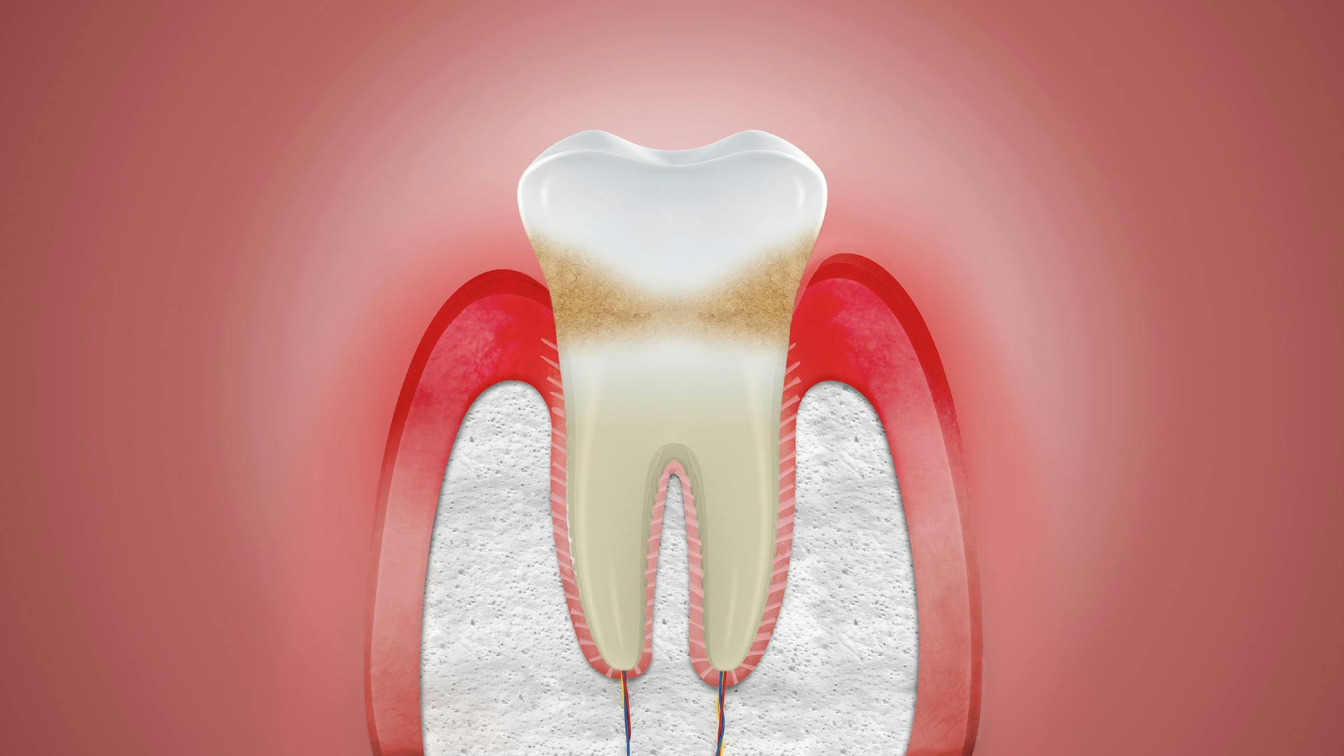 best toothbrush for swollen gums