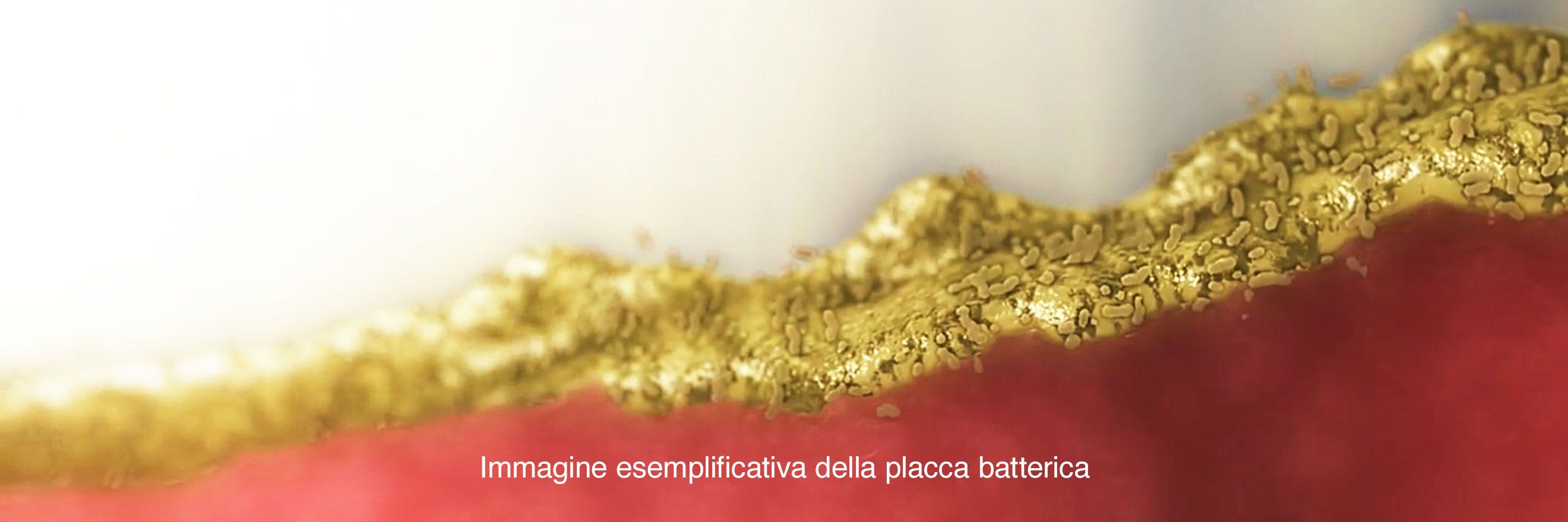 Immagine rappresentativa dei batteri su bordo gengivale
