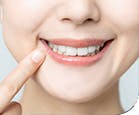What Is Plaque, and Is It Really Dangerous? What Is Plaque, and Is It Really Dangerous?