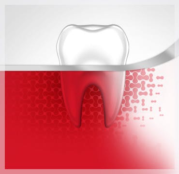 Bleeding Gums Tooth Gum Disease Stage 1 parodontax Bleeding Gums Tooth Gum Disease Stage 1 parodontax