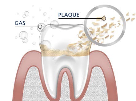Teeth Cleaning parodontax Teeth Cleaning parodontax