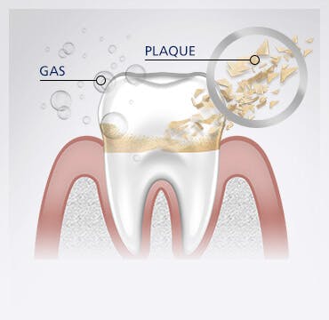 Teeth Cleaning parodontax Teeth Cleaning parodontax