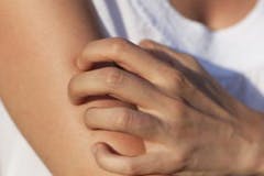 Person scratching their arm Person scratching their arm