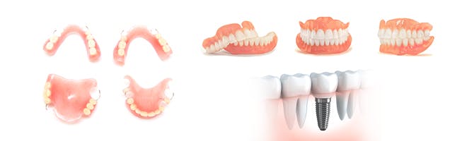 What are different ways to replace your missing teeth header image Woman and man up close to each other