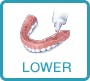 lower-potion lower-potion