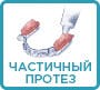 частичный зубной протез как правильно наносить средство для фиксации зубных протезов на частичный протез