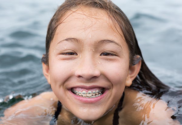 Girl With Braces Swimming Girl With Braces Swimming